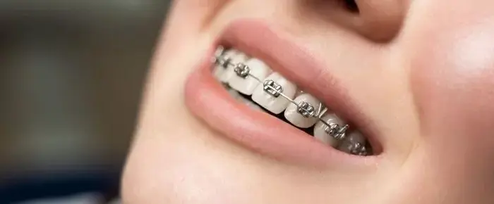 Ryanorthodonticlabllc